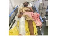 K'taka acid attacker injured in police shootout